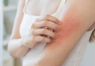 Prurito alla pelle in autunno: le cause e i rimedi