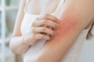 Prurito alla pelle in autunno: le cause e i rimedi