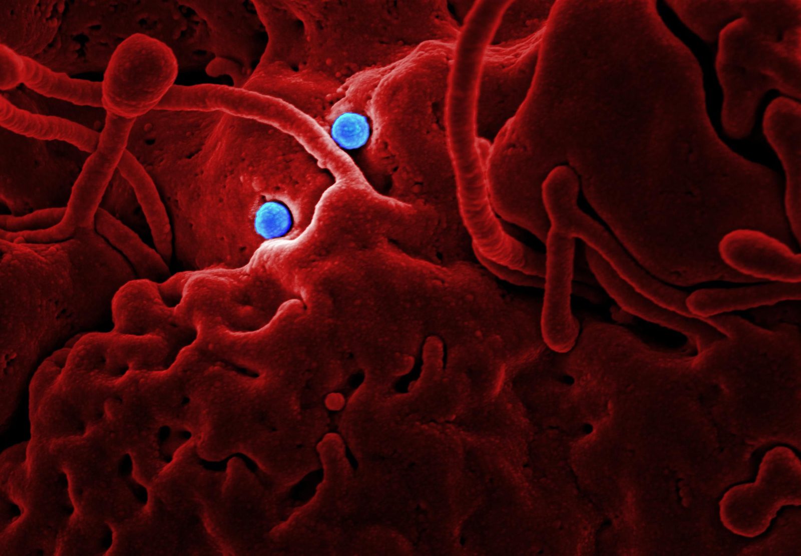Immagine al microscopio elettronico di un virus influenzale colorato artificialmente Immagine al microscopio elettronico di un virus influenzale colorato artificialmente